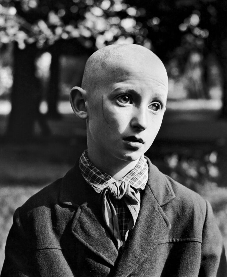 Black & white photography by Antanas Sutkus, portrait of blind boy, Kaunas, Lithuania, 1962. From Planet Lithuania