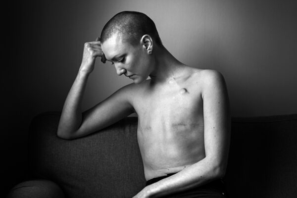 black and white studio portrait of a woiman with breast cancer by Martina Holmberg