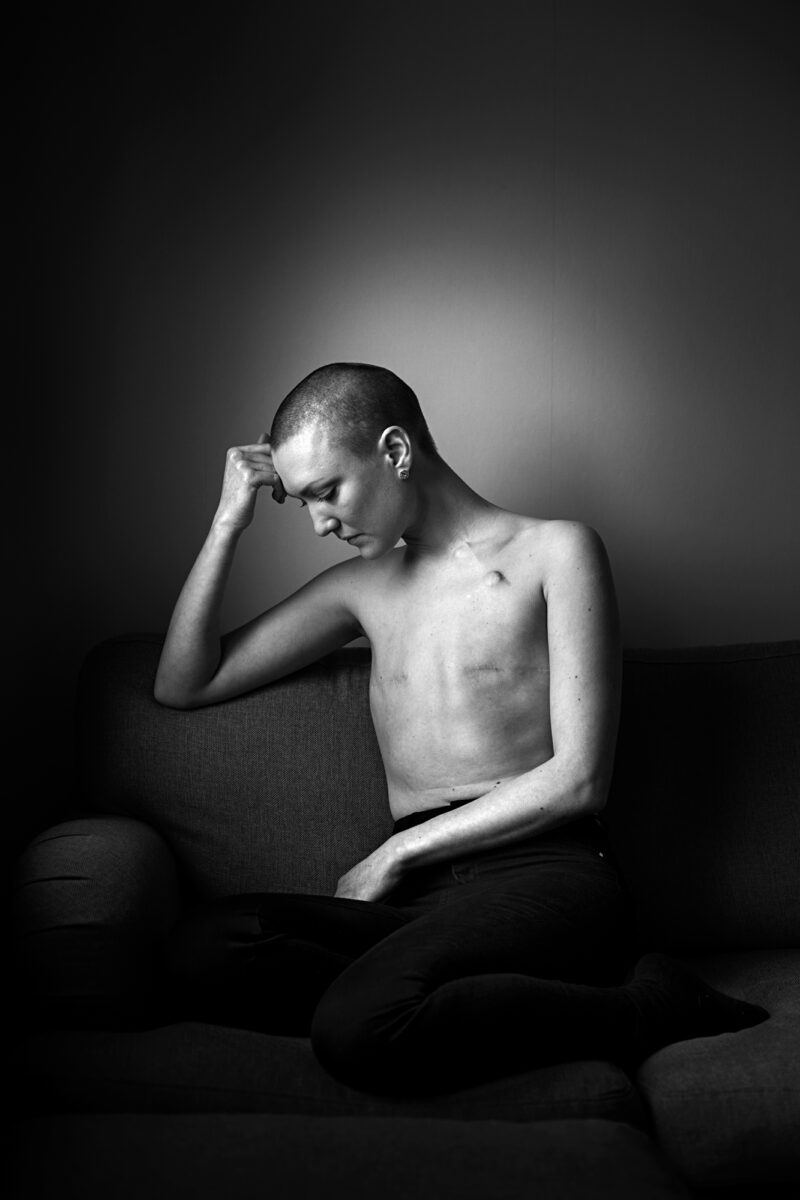 black and white studio portrait of a woiman with breast cancer by Martina Holmberg